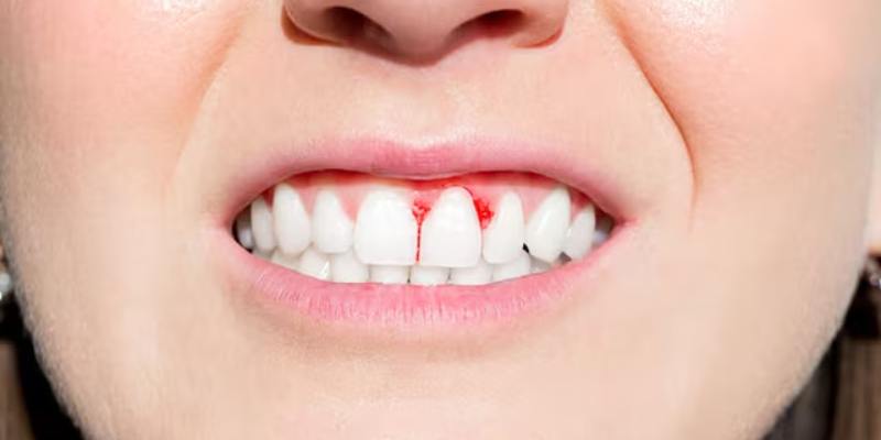 Thông điệp mơ thấy gãy răng chảy máu khi bị ngã